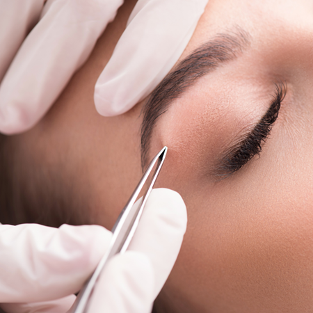 Labio superior, mentón o cejas